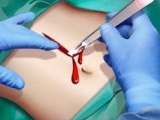 تنزيل لعبة Surgery Master احدث اصدار للاندرويد apk